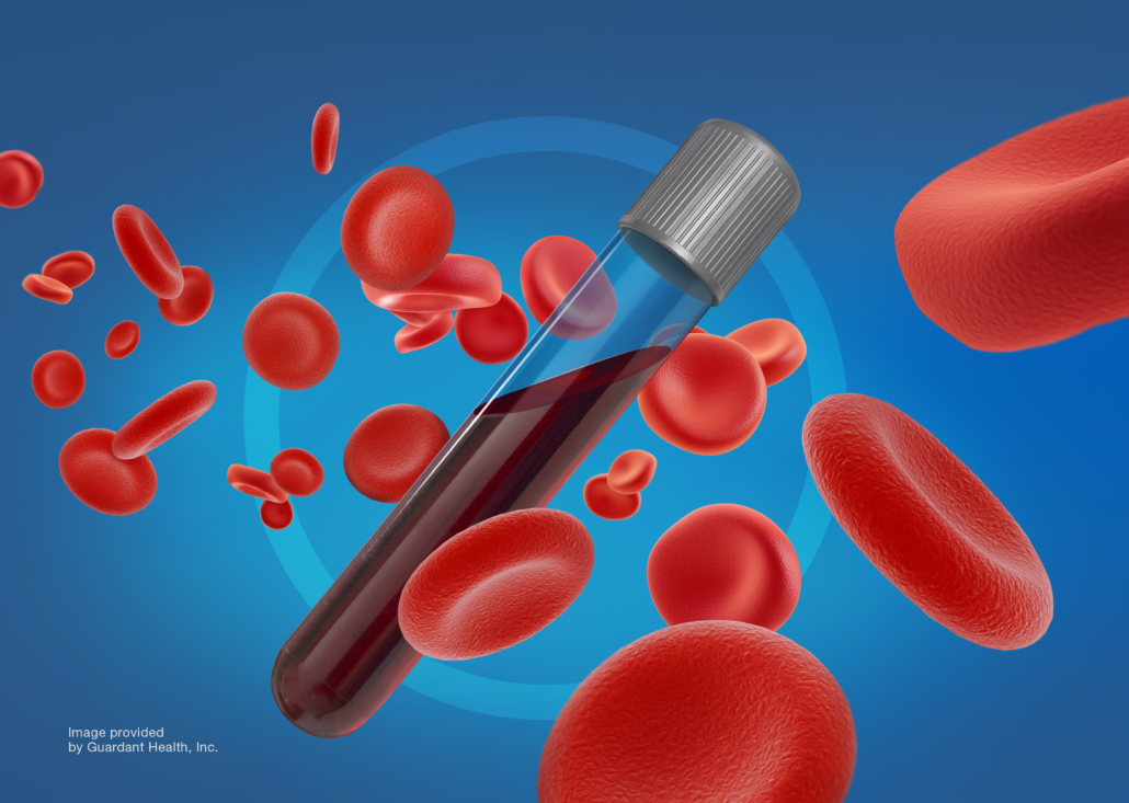Large-Scale Study Shows Guardant360 Liquid Biopsy Accelerates Clinical Trial Enrollment Compared to Tissue Biopsy